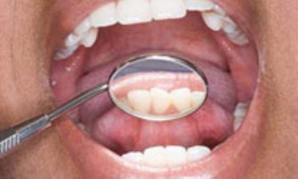 پوسیدگی به دندان شما نزدیک است